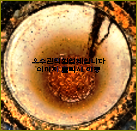 하수구