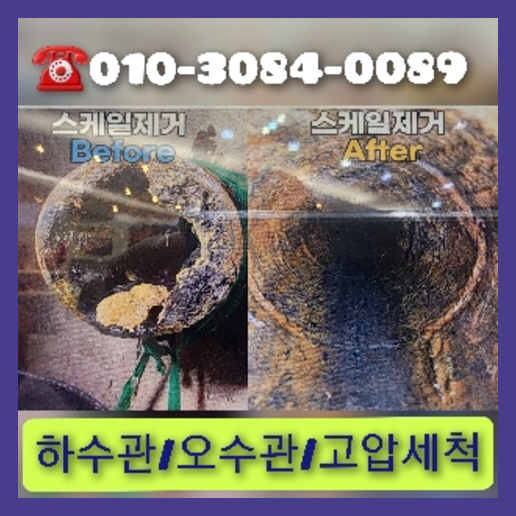 횡주관세척추천